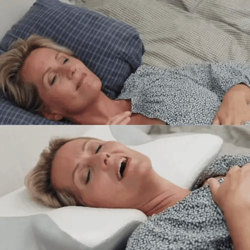 Serenight™ – Olajšanje za vrat