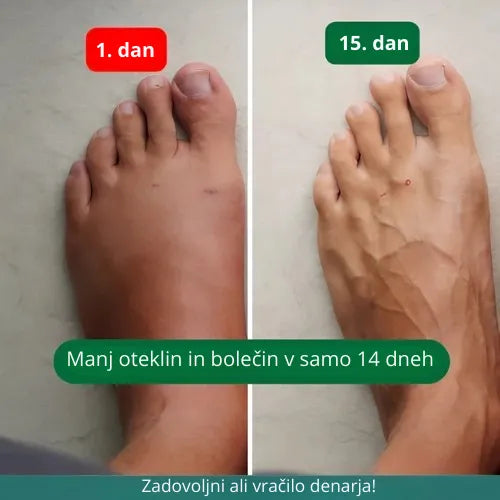 Zenstride® Zračne kompresijske nogavice za noge in stopala brez bolečin