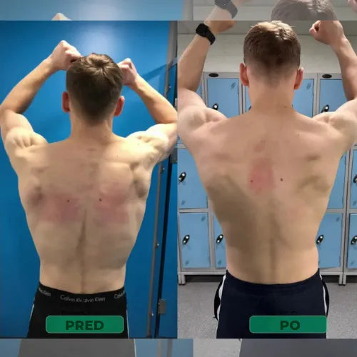 Korektor drže – Stoj pokonci. Olajšaj hrbet. Občuti razliko že prvi dan.