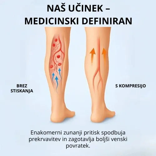 Zenstride® Zračne kompresijske nogavice za noge in stopala brez bolečin